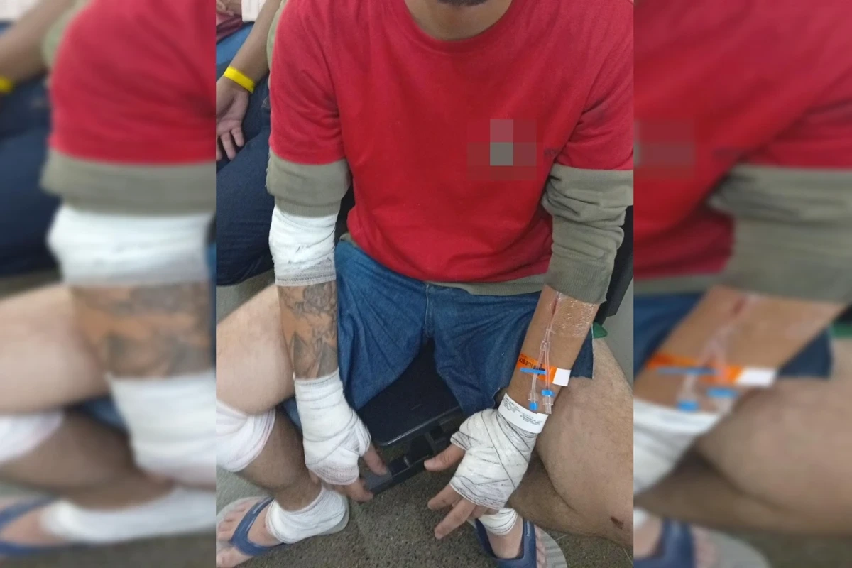 Motociclista Quebra o Baço Após Acidente com Carro em Via do DF