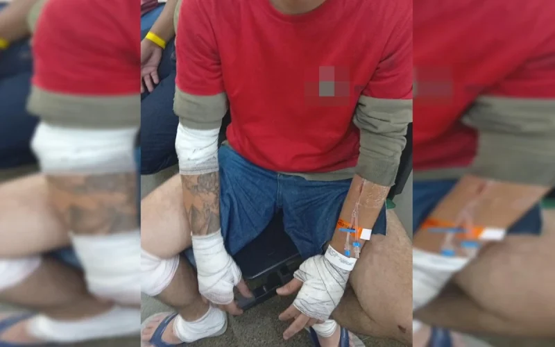 Motociclista Quebra o Baço Após Acidente com Carro em Via do DF